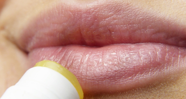 Trockene Lippen im Winter: Diese Lippenpflegen solltest du vermeiden